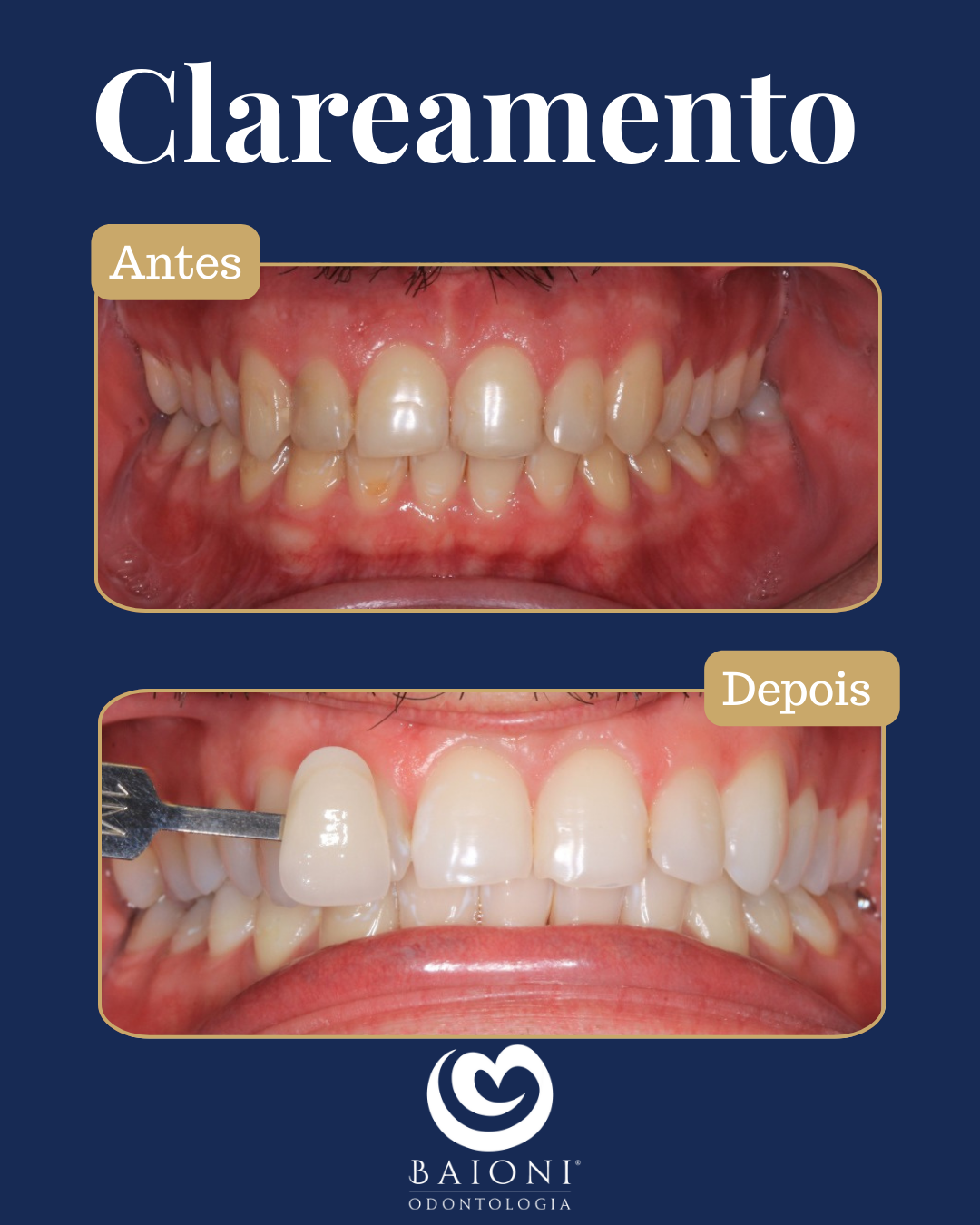 antes e depois (1)