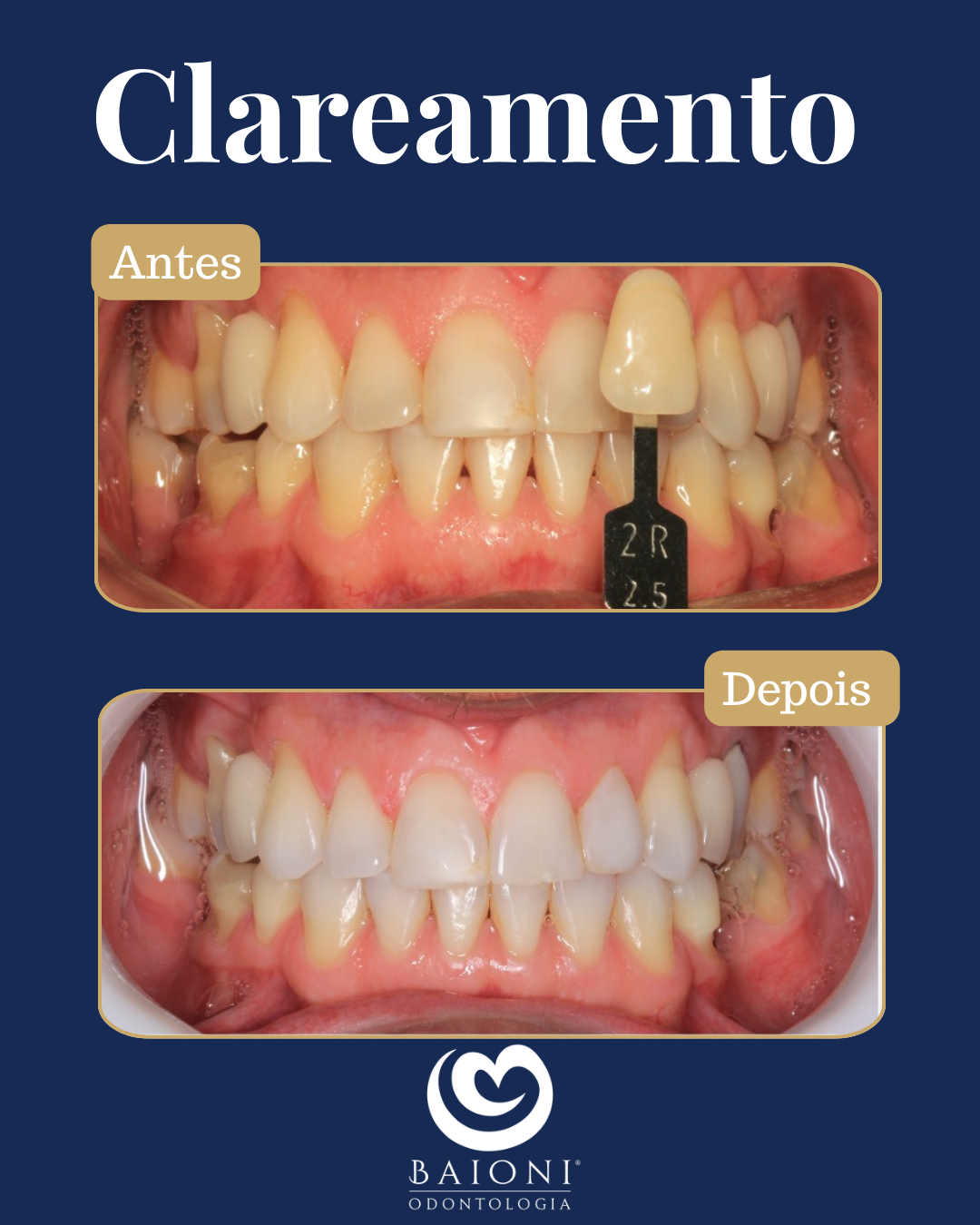 antes e depois (2)