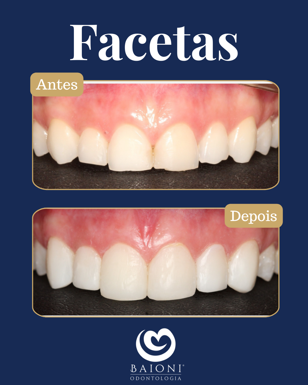 antes e depois (3)
