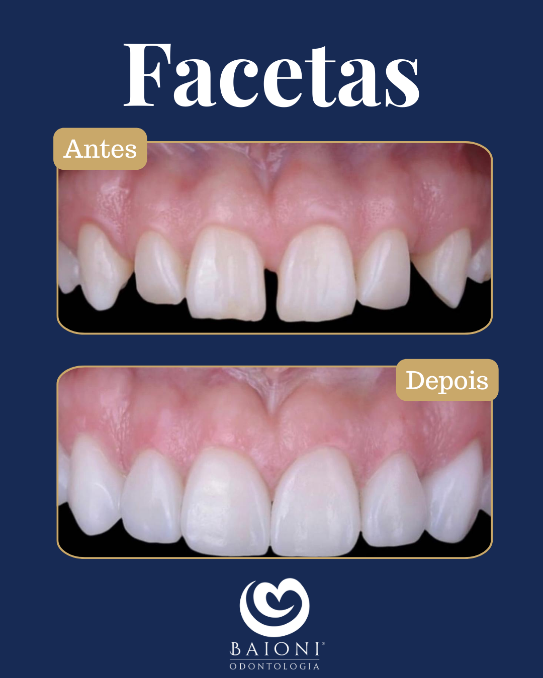 antes e depois (4)