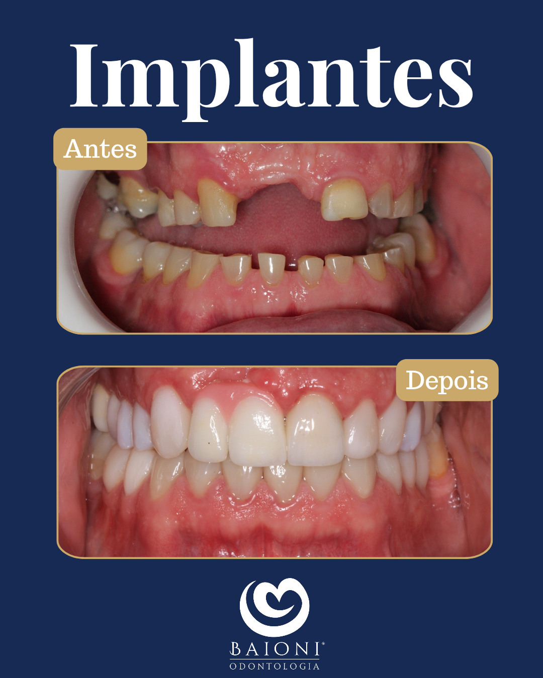 antes e depois_20250924_173733_0000