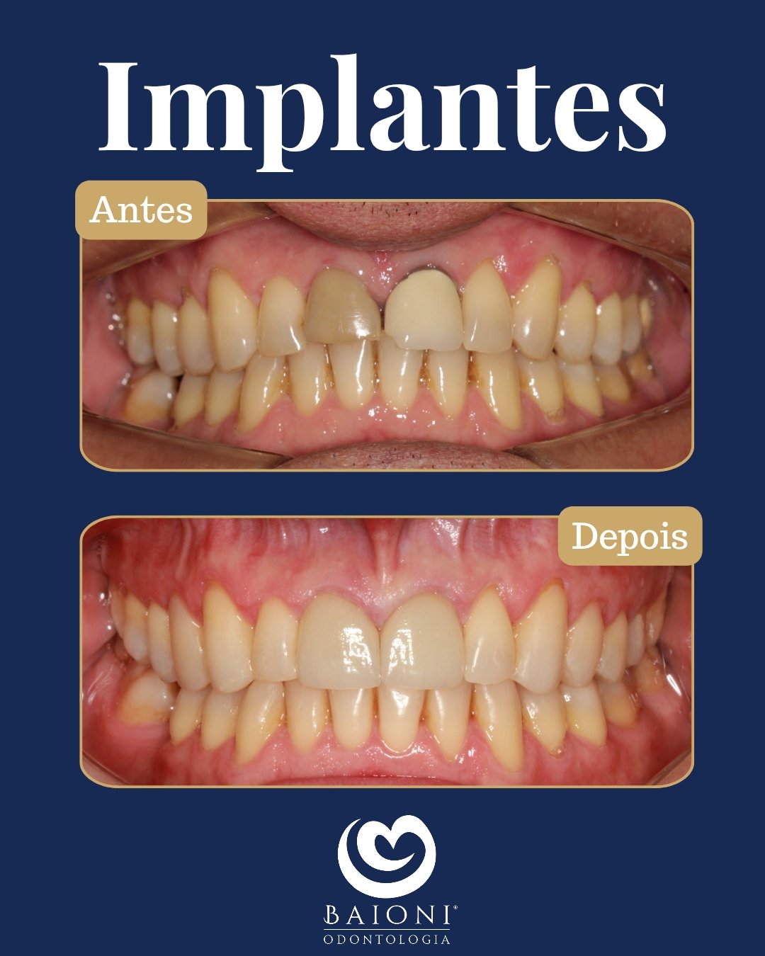 antes e depois_20250924_191121_0000