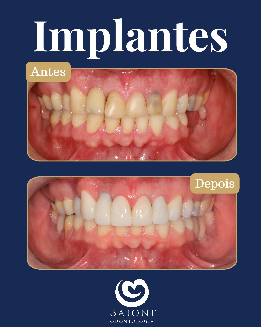 antes e depois_20250924_191314_0000